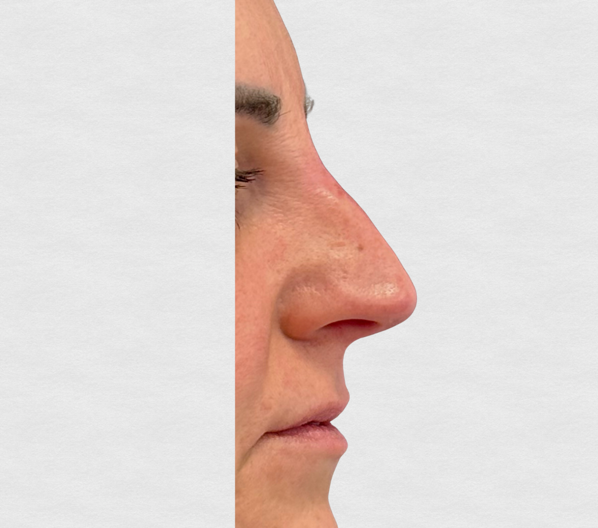 Dopo – Riattivazione sguardo stanco