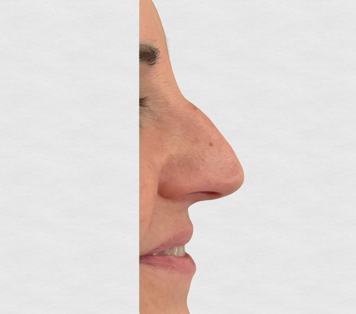 Prima – Riattivazione sguardo stanco