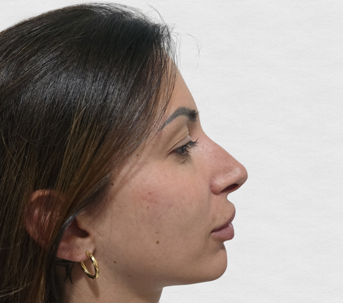 Prima del trattamento — Caso clinico Dr. G