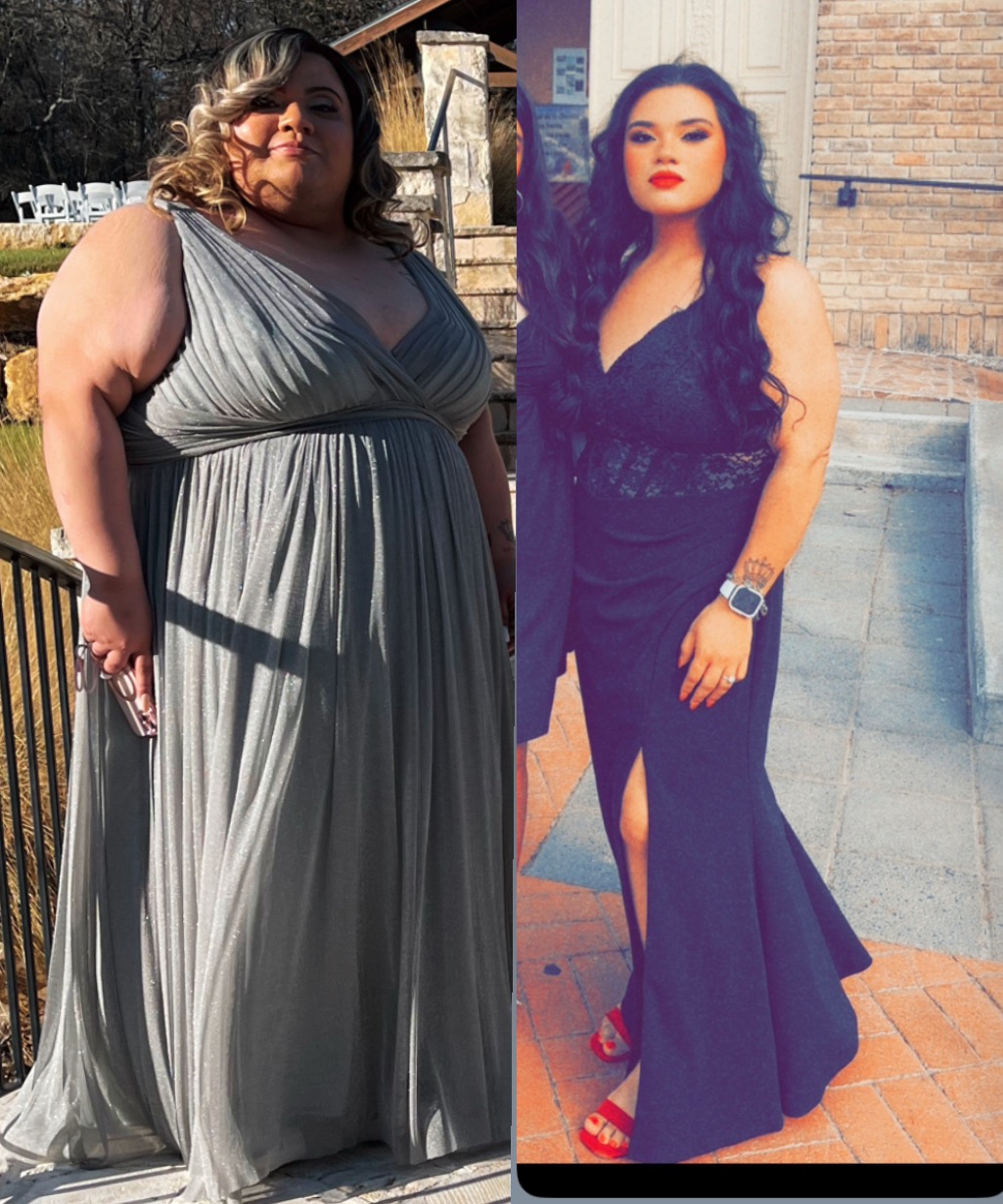 Perla R. before and after — lost 173 lbs at DFW Medi Weight Loss