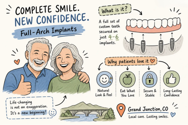 Full-arch implants in Grand Junction: your complete guide