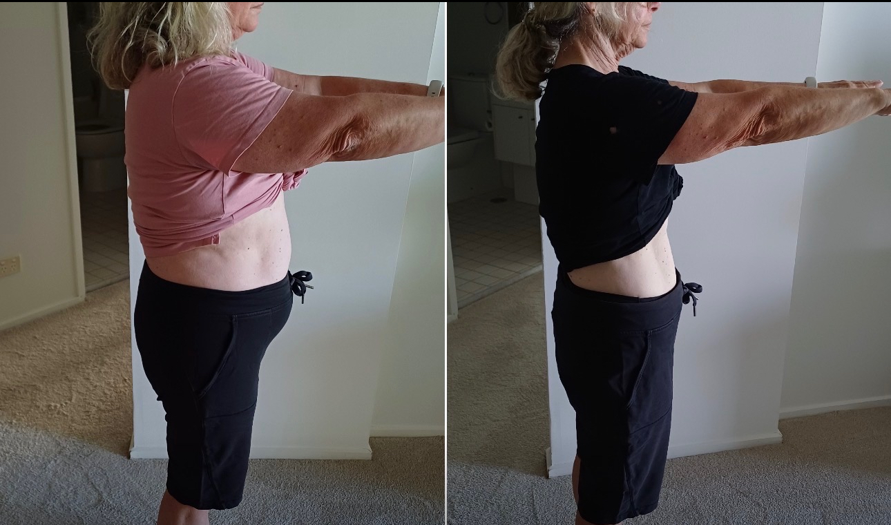 Robyn transformation