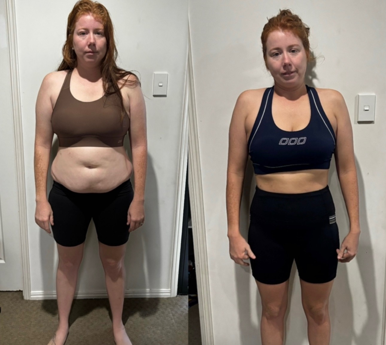 Lauren transformation