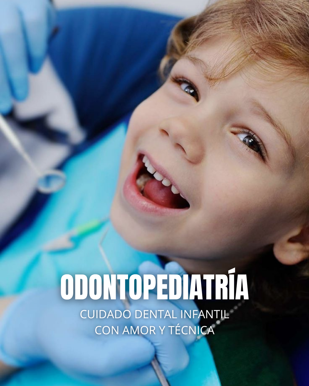 Tratamiento 3