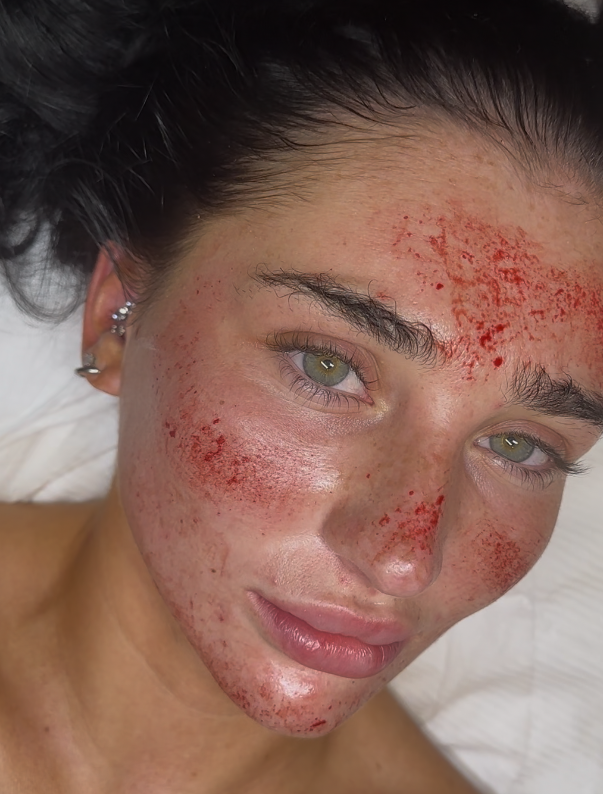 Anti-Aging & Wrinkle Reduction Midtown Miami