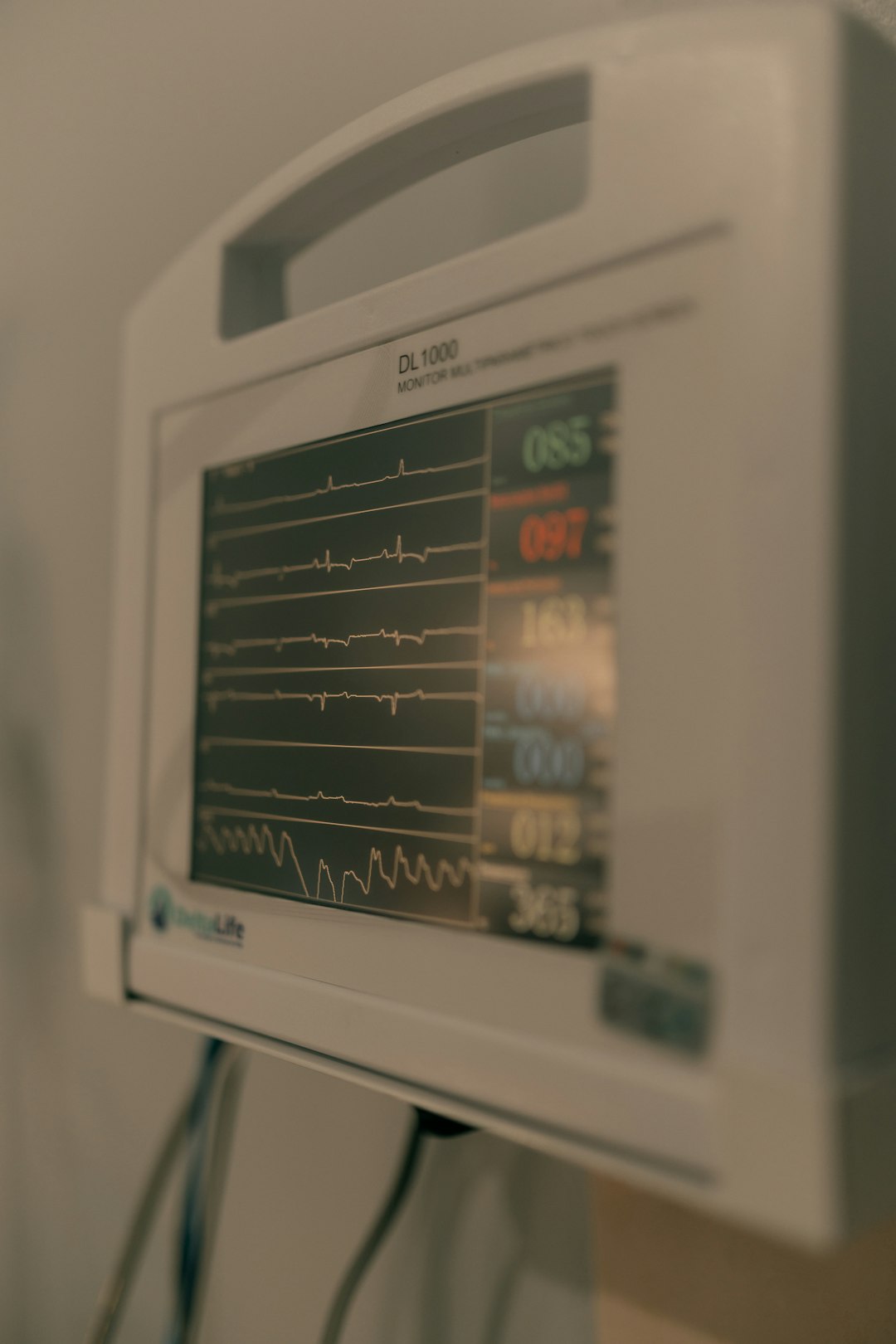 hospital monitor with vital signs showing 