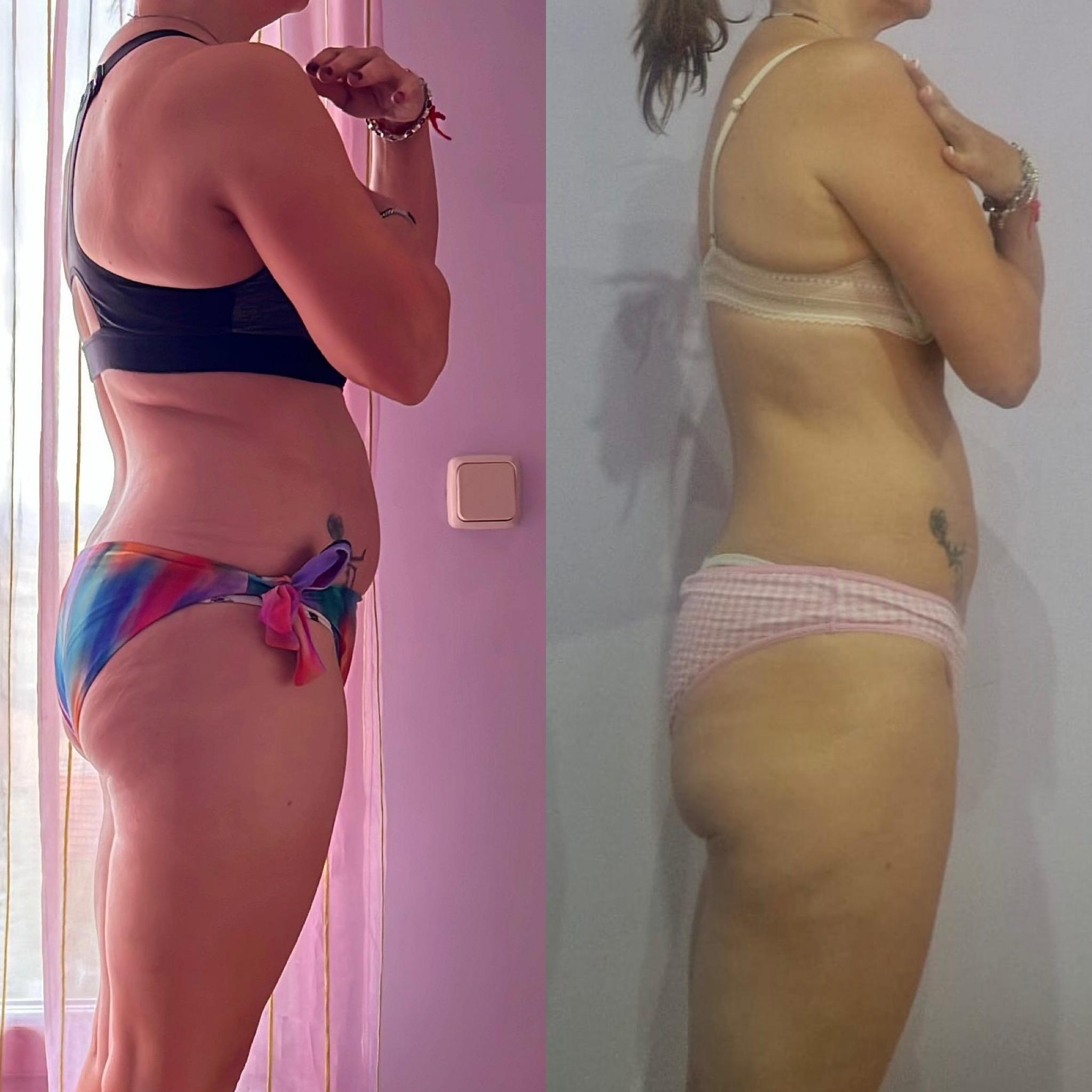Antes y después de ESTHER