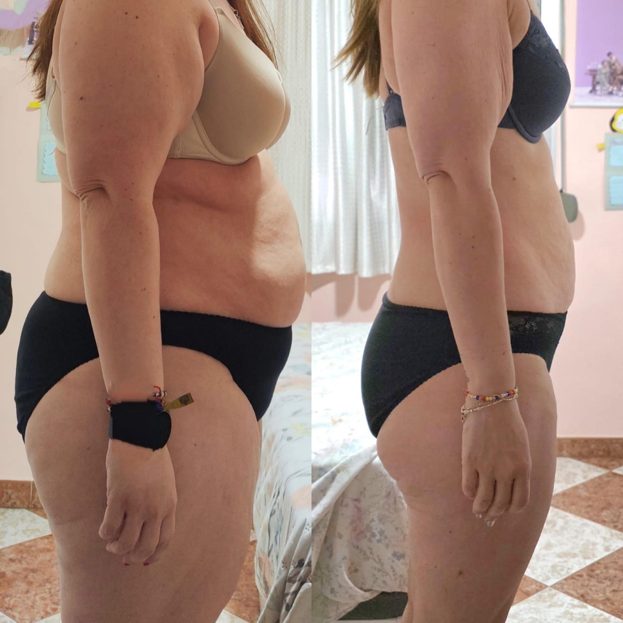 Antes y después de LIDIA