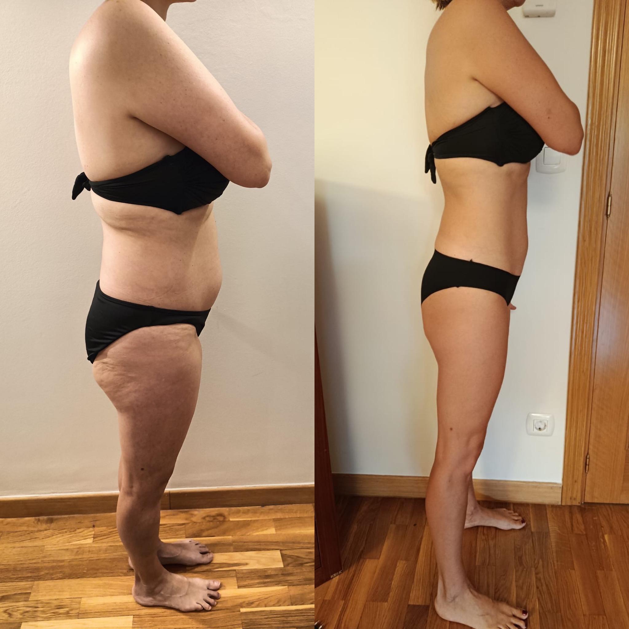 Antes y después de EDURNE