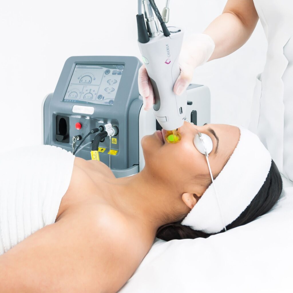Laser hair removal at Euphoria