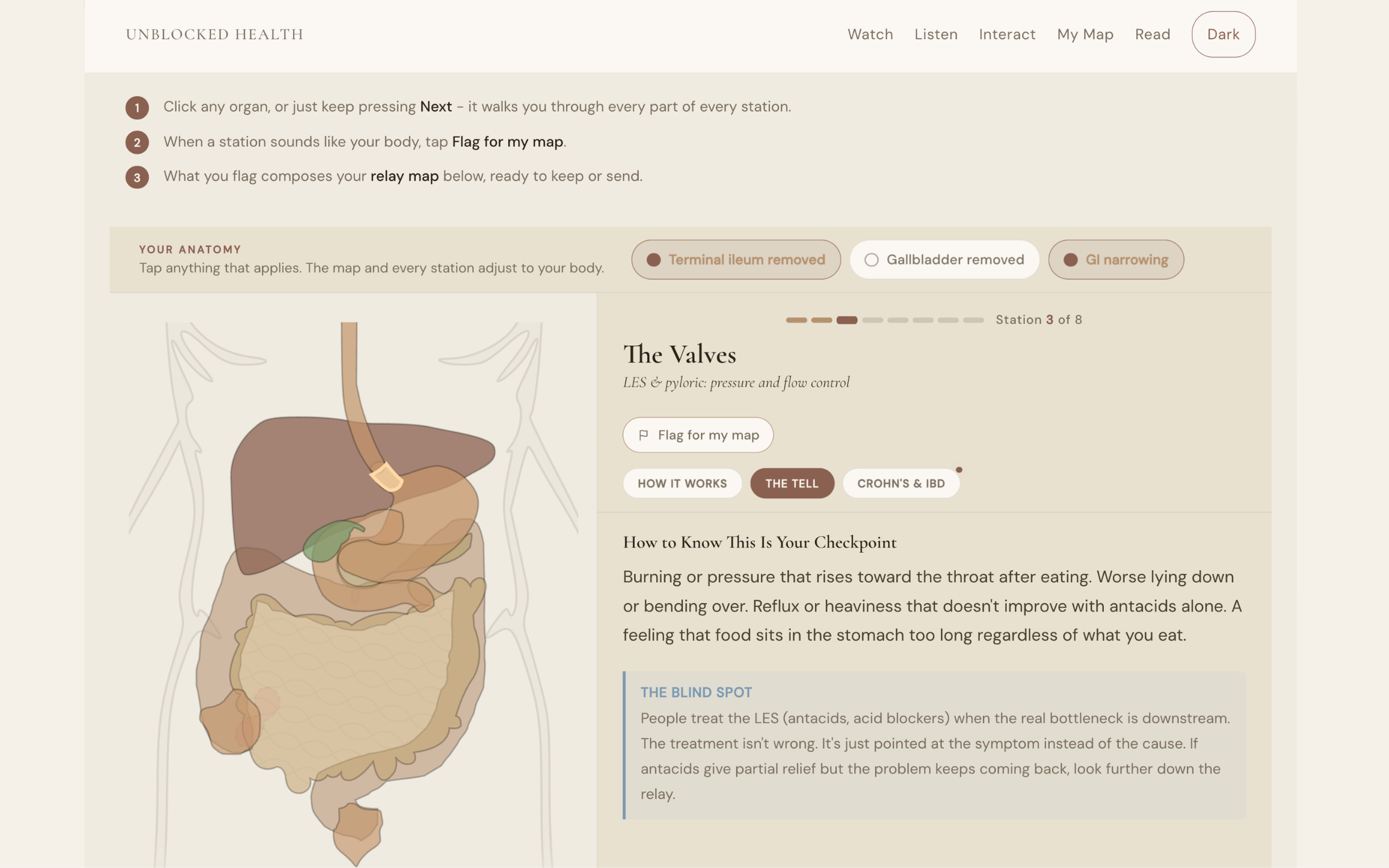 Interactive digestive learning experience