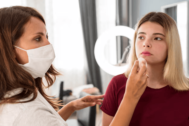 Melasma