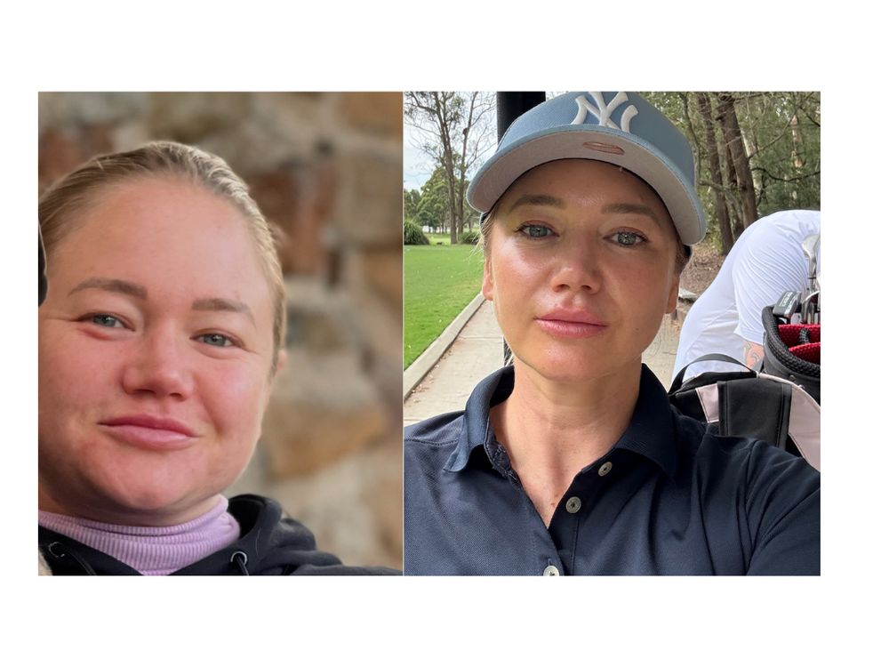 Michaela Sparrow before and after treating the root causes of her inflammation and puffiness