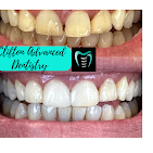 advanced smile makeover case Clifton NJ