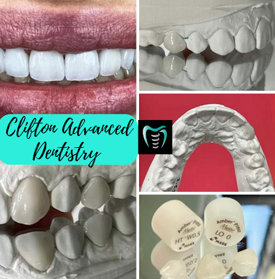 advanced smile makeover case Clifton NJ