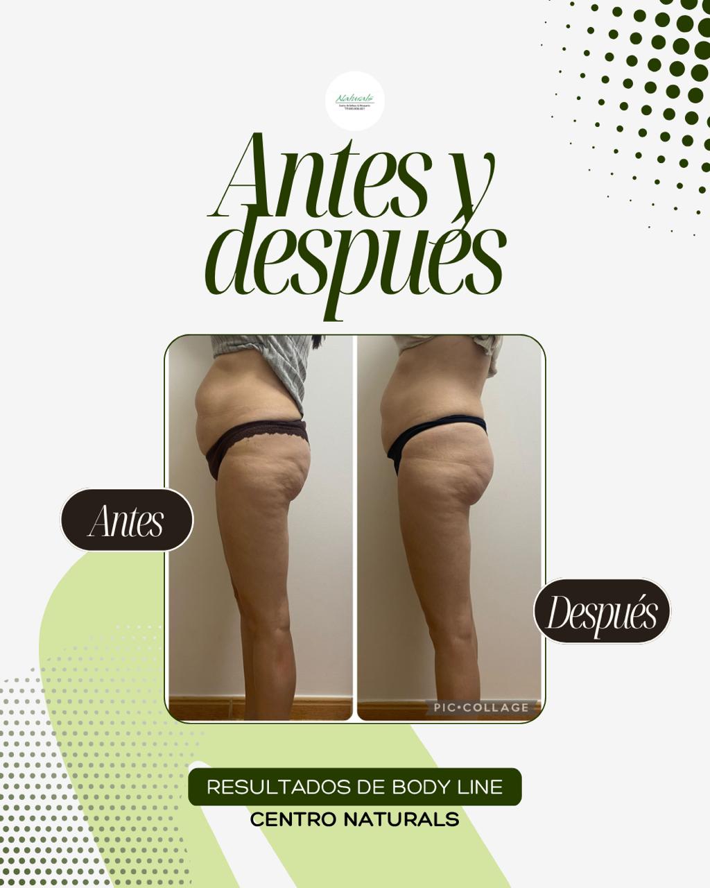 Antes y después Body Line