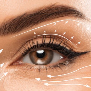 Blepharoplasty