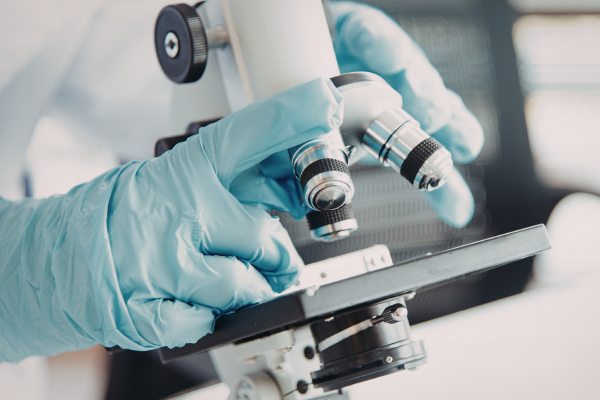 How to Get Rid of Mold Mites and Prevent Them in Your Home