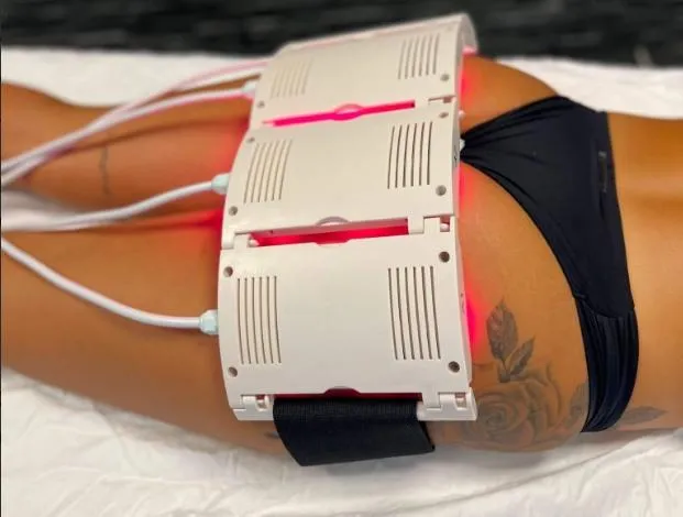 5D Lipo Laser treatment at Stuart MedSpa