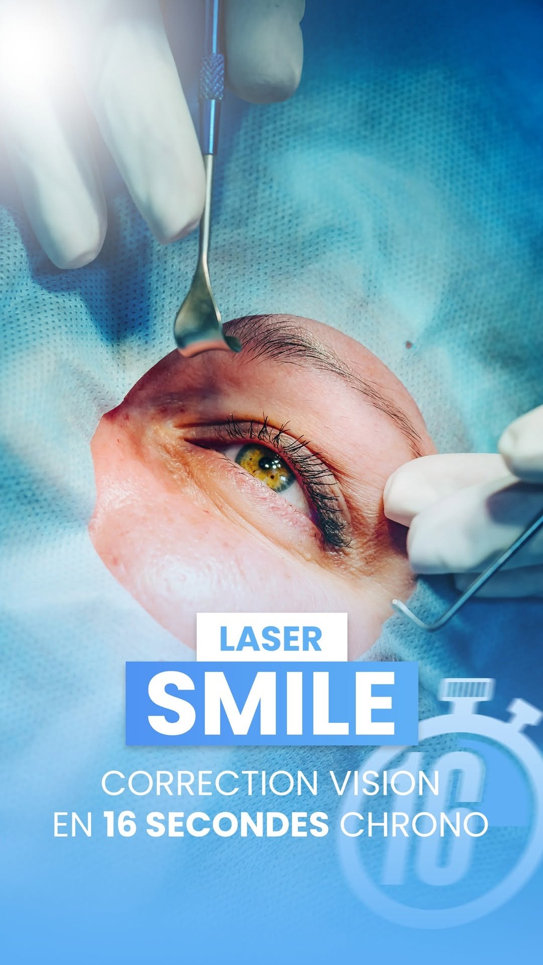 Laser SMILE : correction en 16 secondes