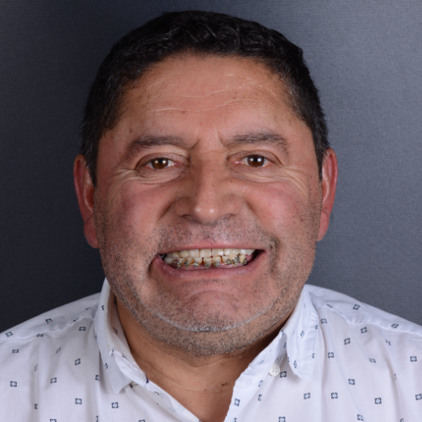 Luis T. — Antes