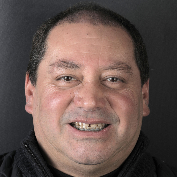 Pedro B. — Antes