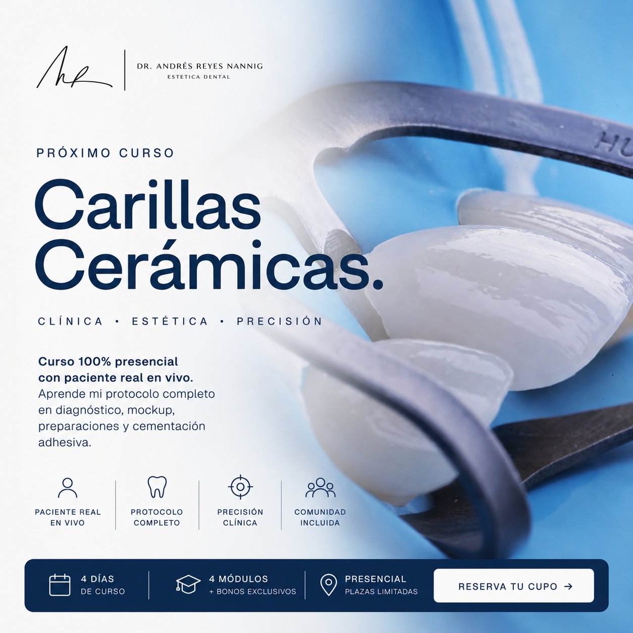 Curso Clínico de Carillas