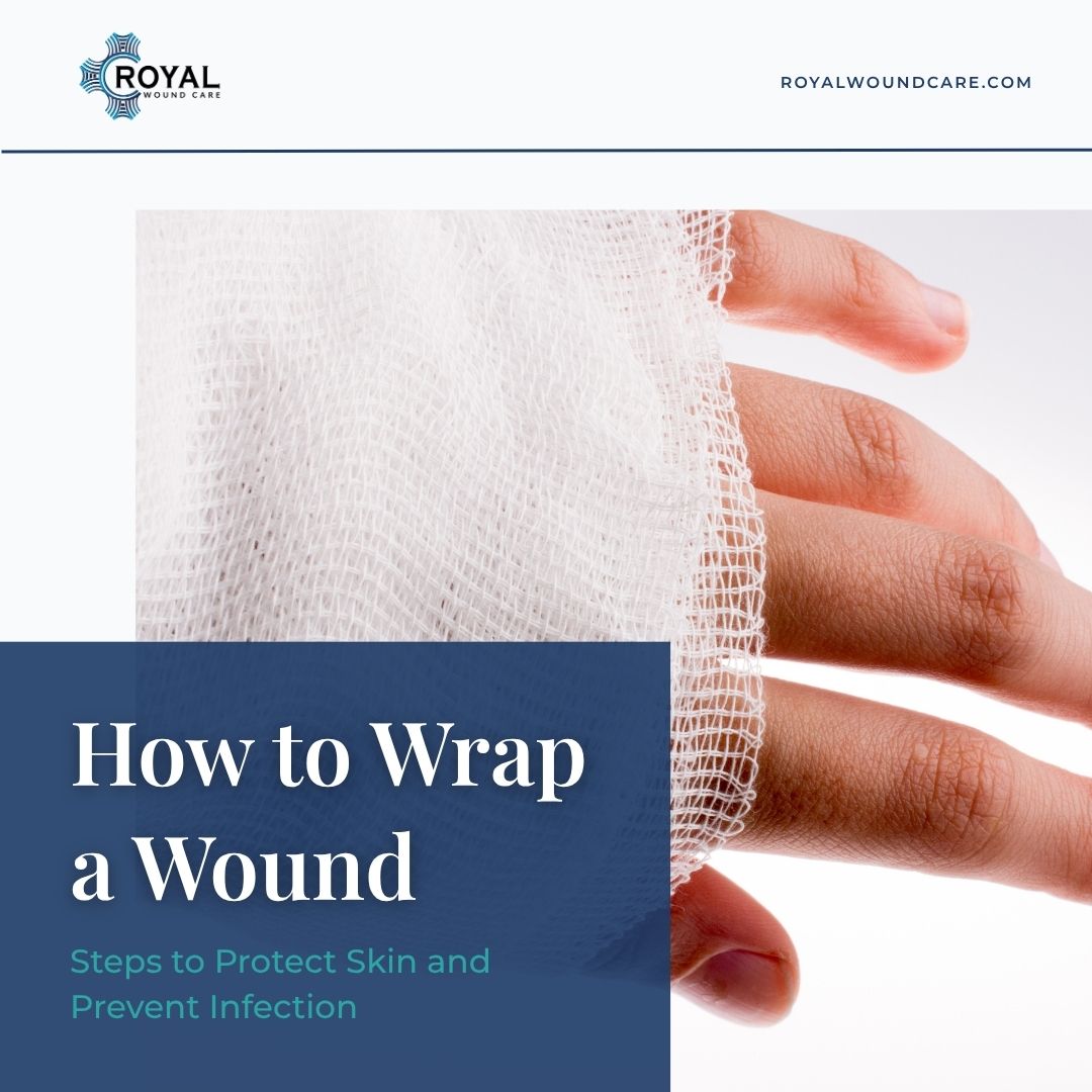 How to Wrap a Wound How to Wrap a Wound