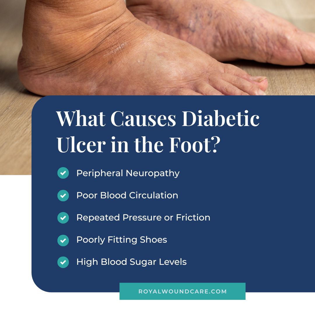 What Causes Diabetic Ulcer in the Foot