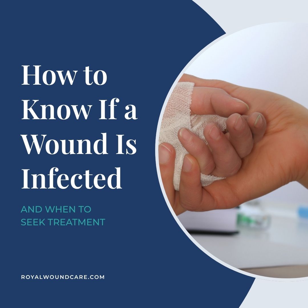 How to Know If a Wound Is Infected How to Know If a Wound Is Infected