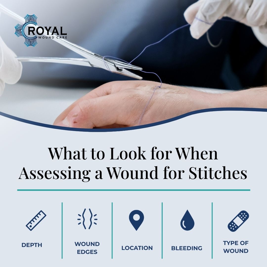 What to Look for When Assessing a Wound for Stitches