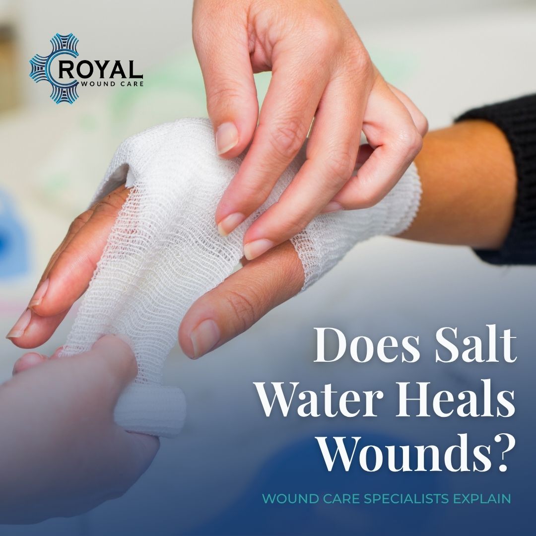 Does Salt Water Heals Wounds Does Salt Water Heals Wounds