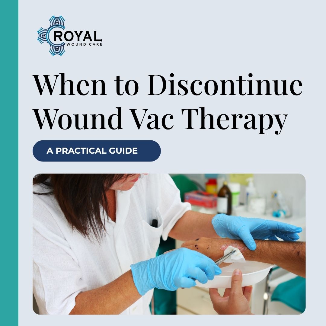 When to Discontinue Wound Vac Therapy When to Discontinue Wound Vac Therapy