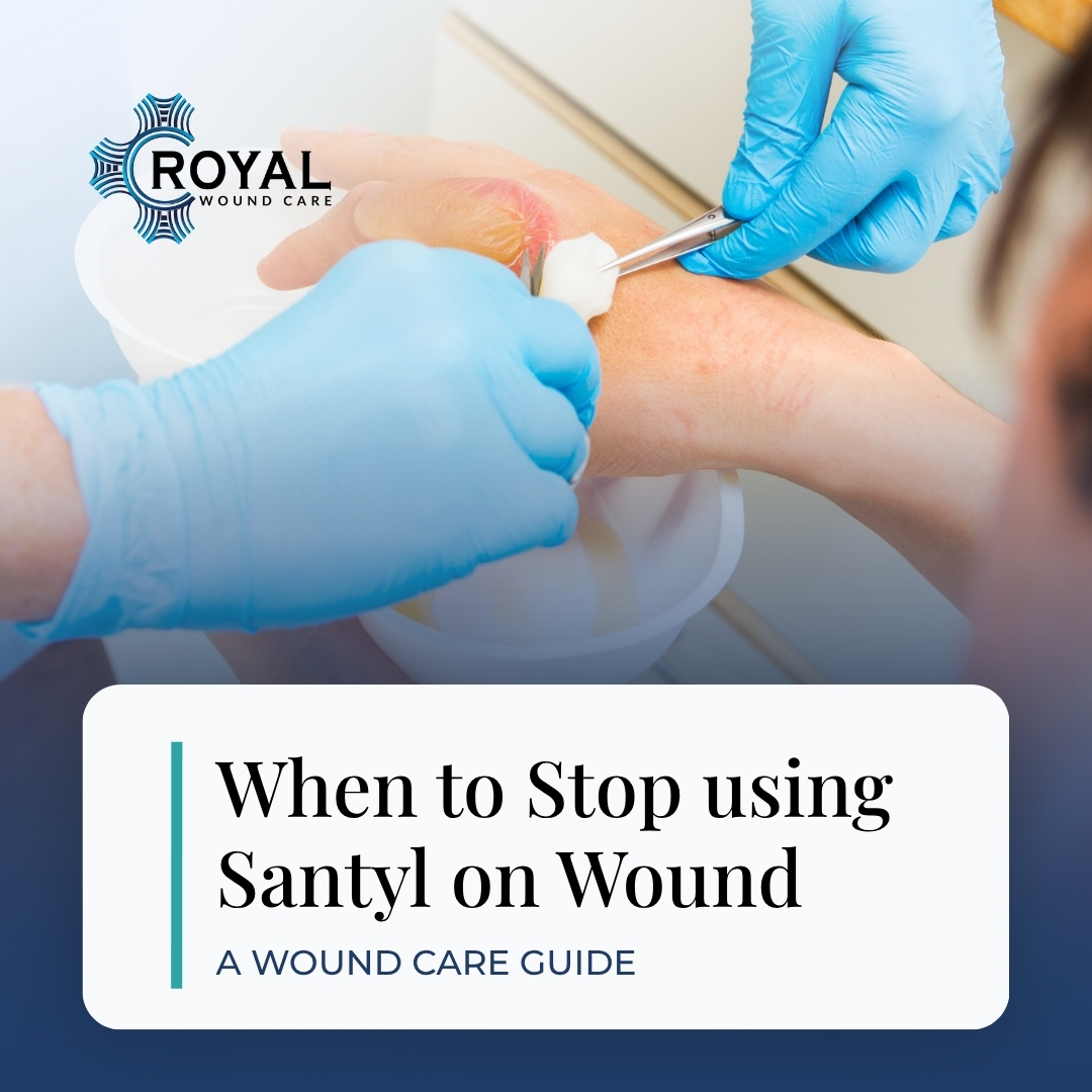 When to Stop using Santyl on Wound When to Stop using Santyl on Wound