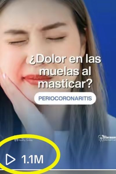 Video sobre dolor de muelas: 1.1 millones de vistas