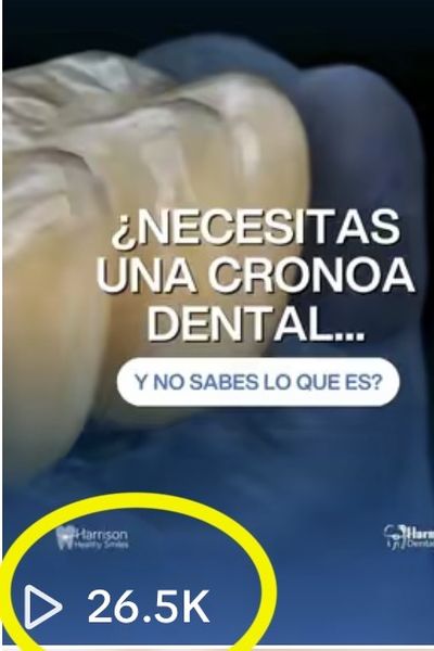 Video sobre coronas dentales: 26.5 mil vistas