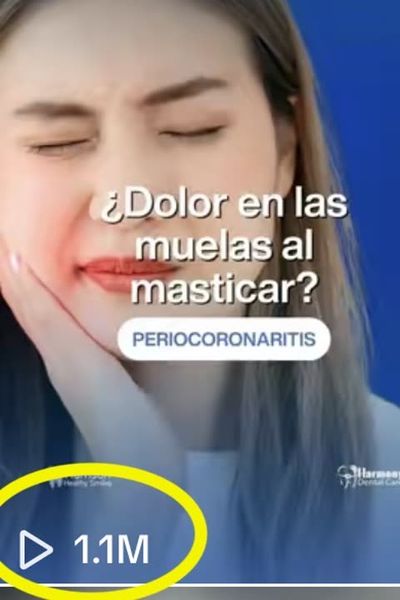 Video dental sobre dolor de muelas, 1.1 millones de vistas