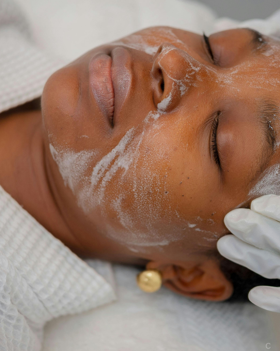 Dermaplaning Radiance Facial