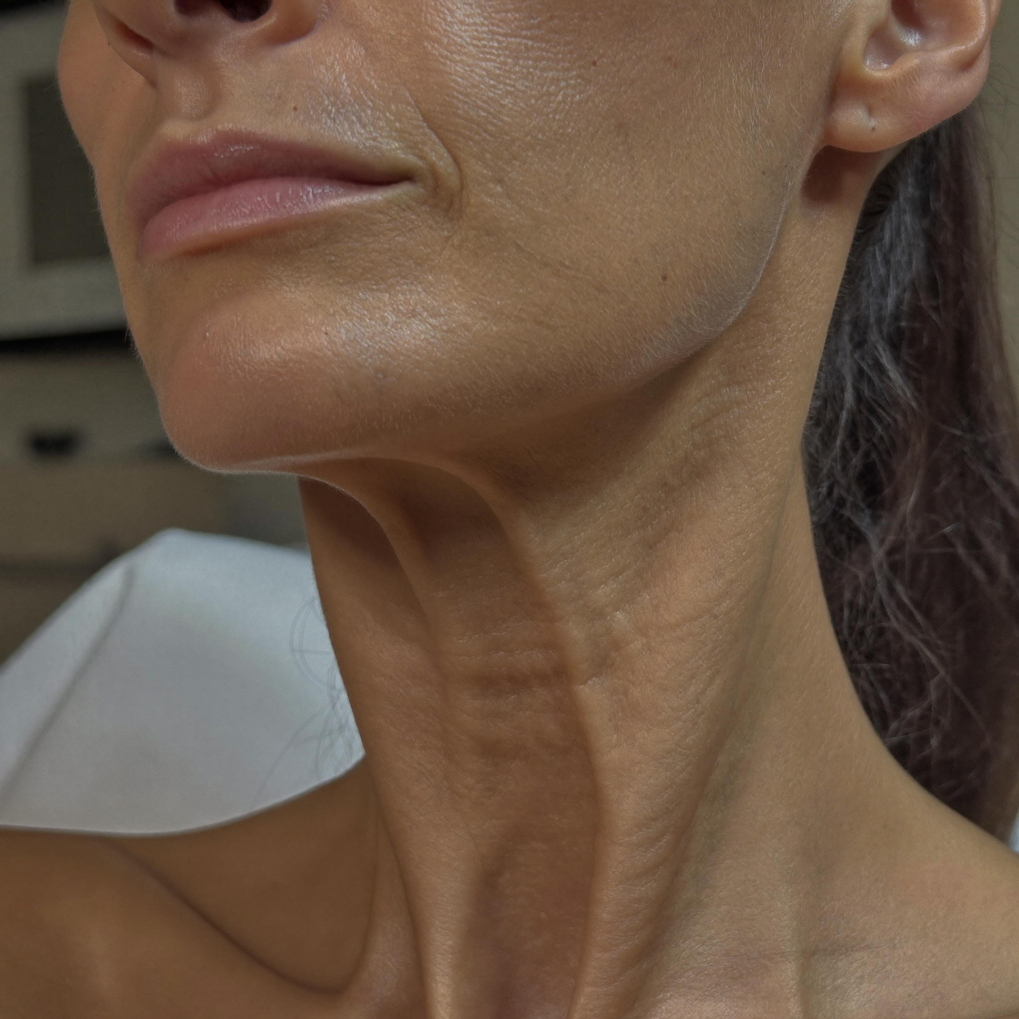 Jawline
