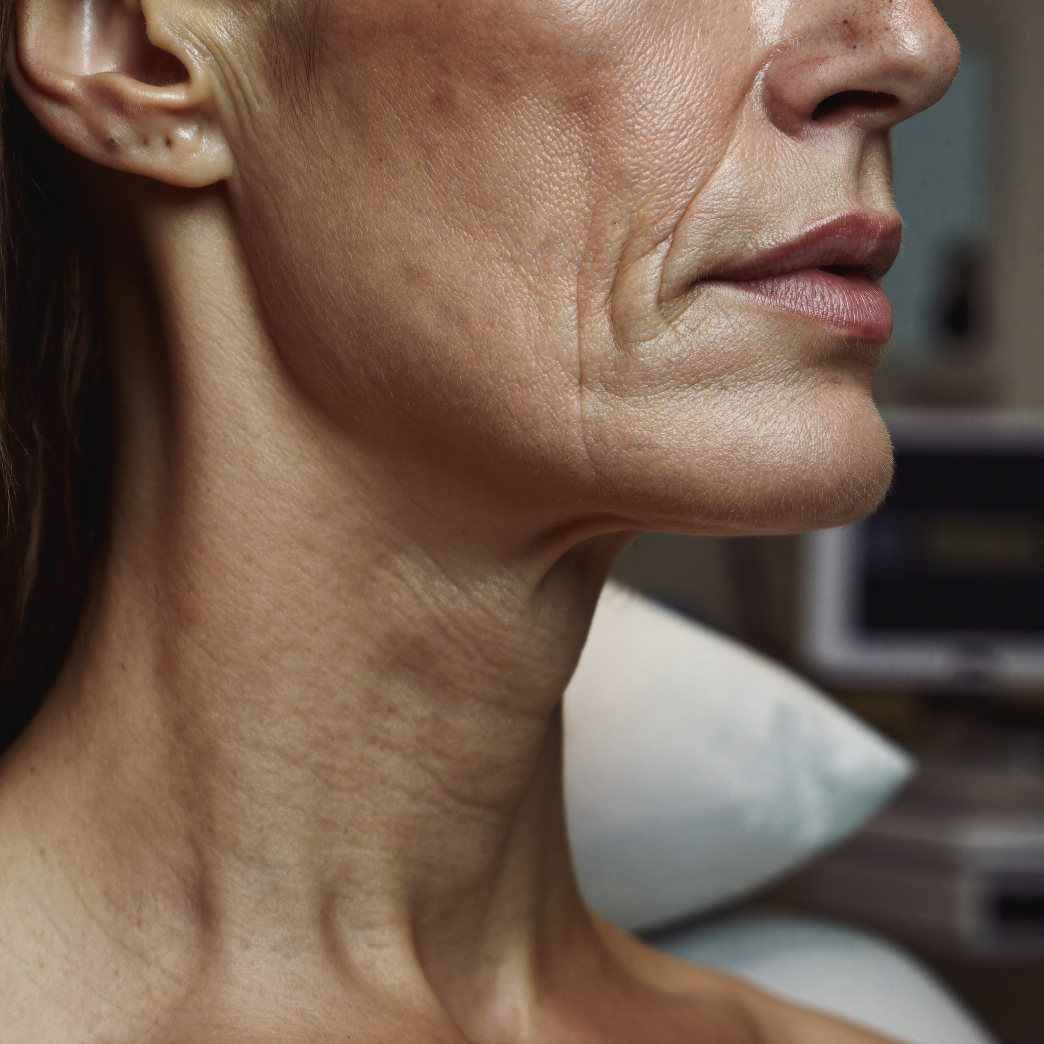 Jawline