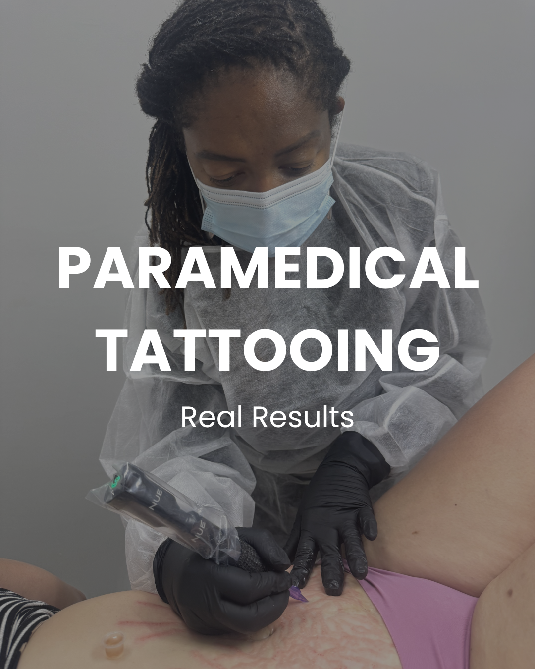 Paramedical Tattooing