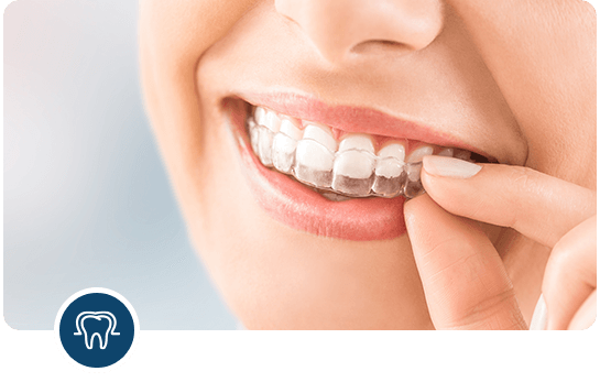 Effective Clear Aligner Solutions