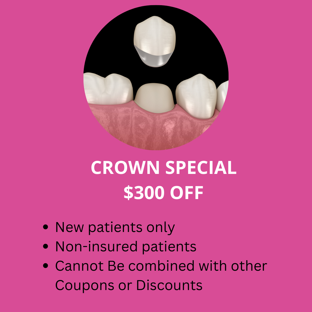 dental crown