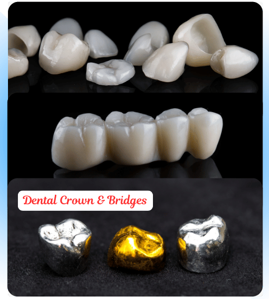 tooth crown