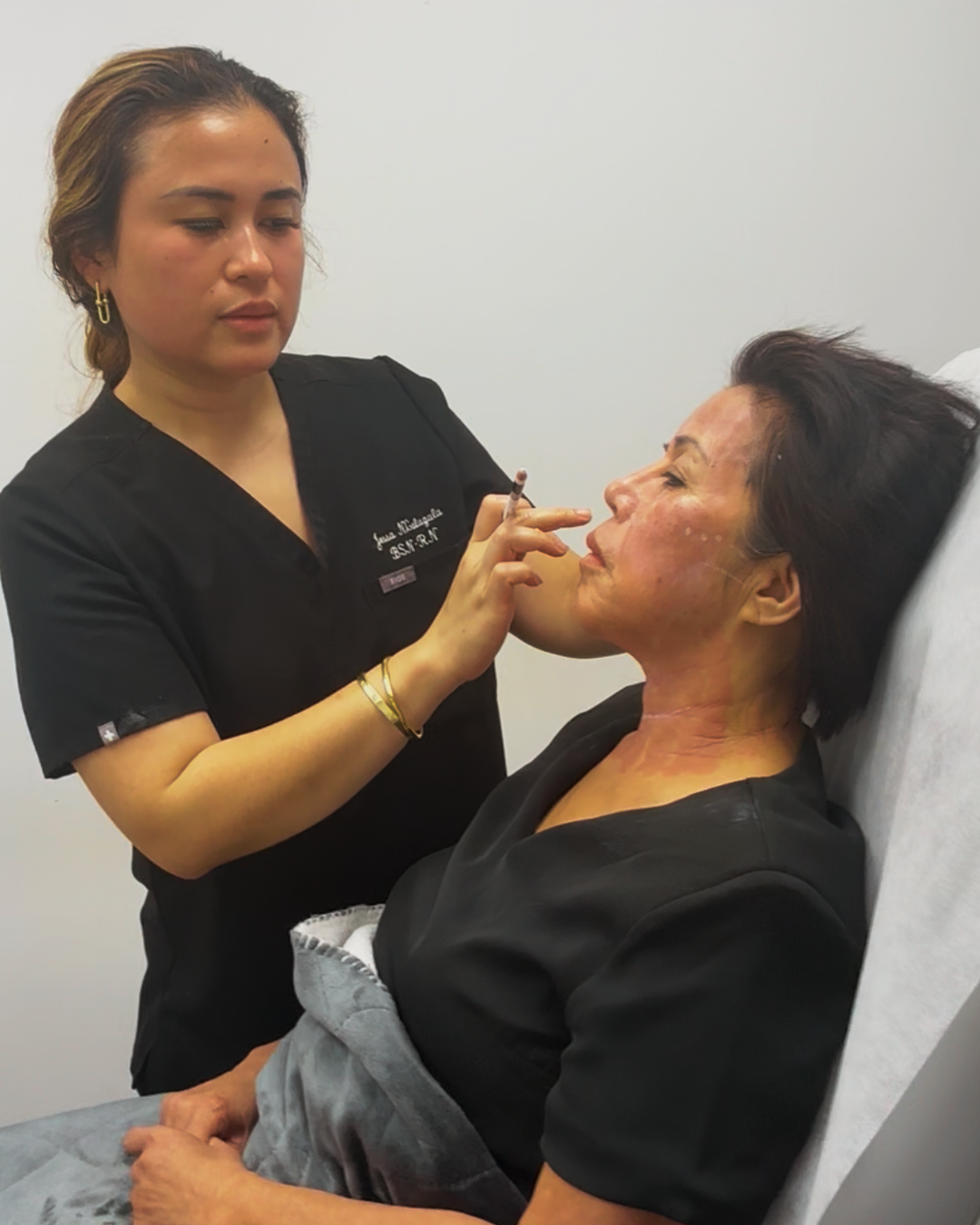 Fillers & Facial Balancing at GlowHaus Skin & Wellness in Allen, TX