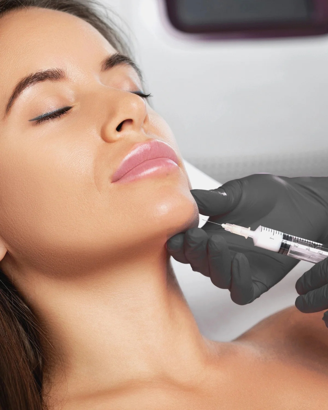 Sculptra at GlowHaus Skin & Wellness in Allen, TX