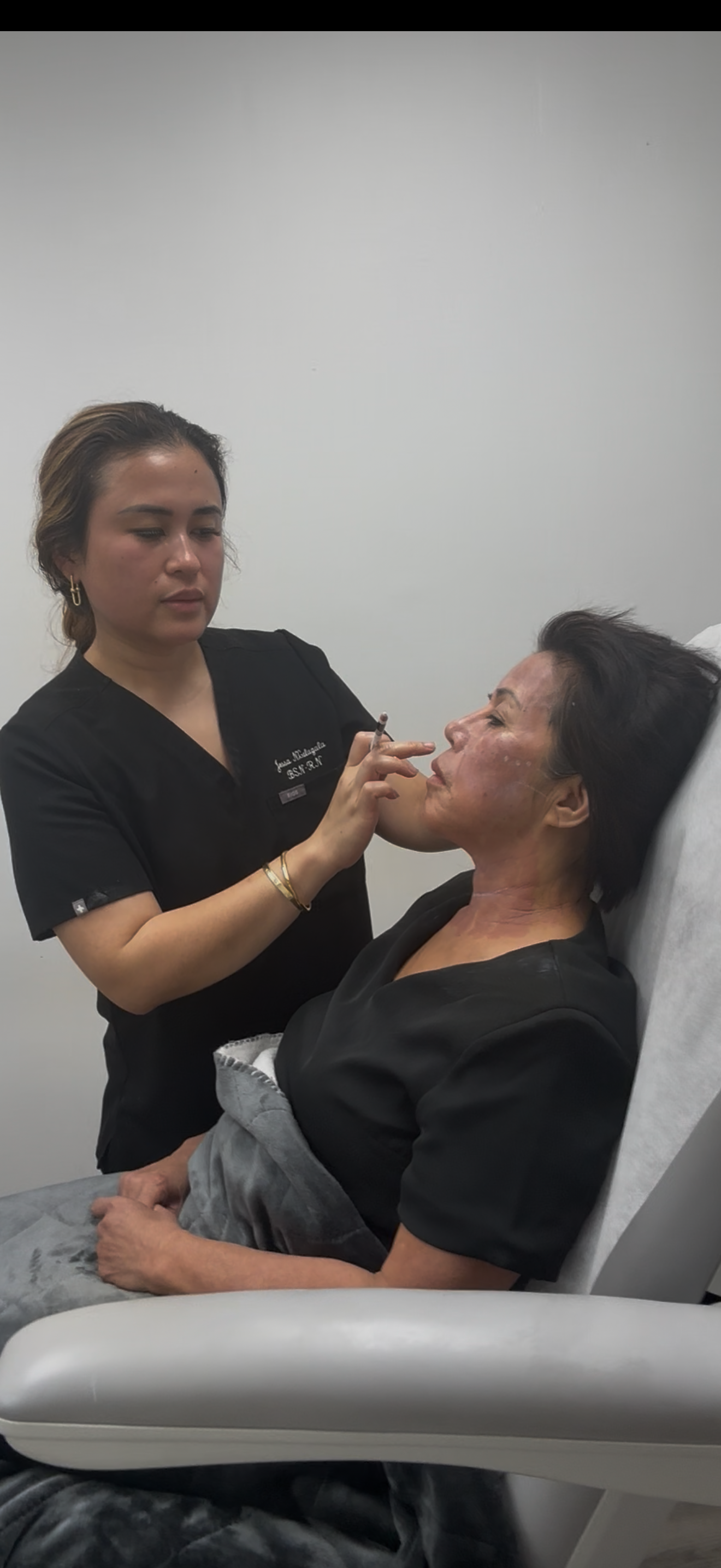 Fillers & Facial Balancing before and after, GlowHaus Skin & Wellness, Allen TX