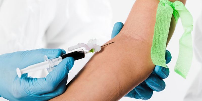 Looking for Home Phlebotomy Services Near Me? Benefits, Costs, and What to Expect