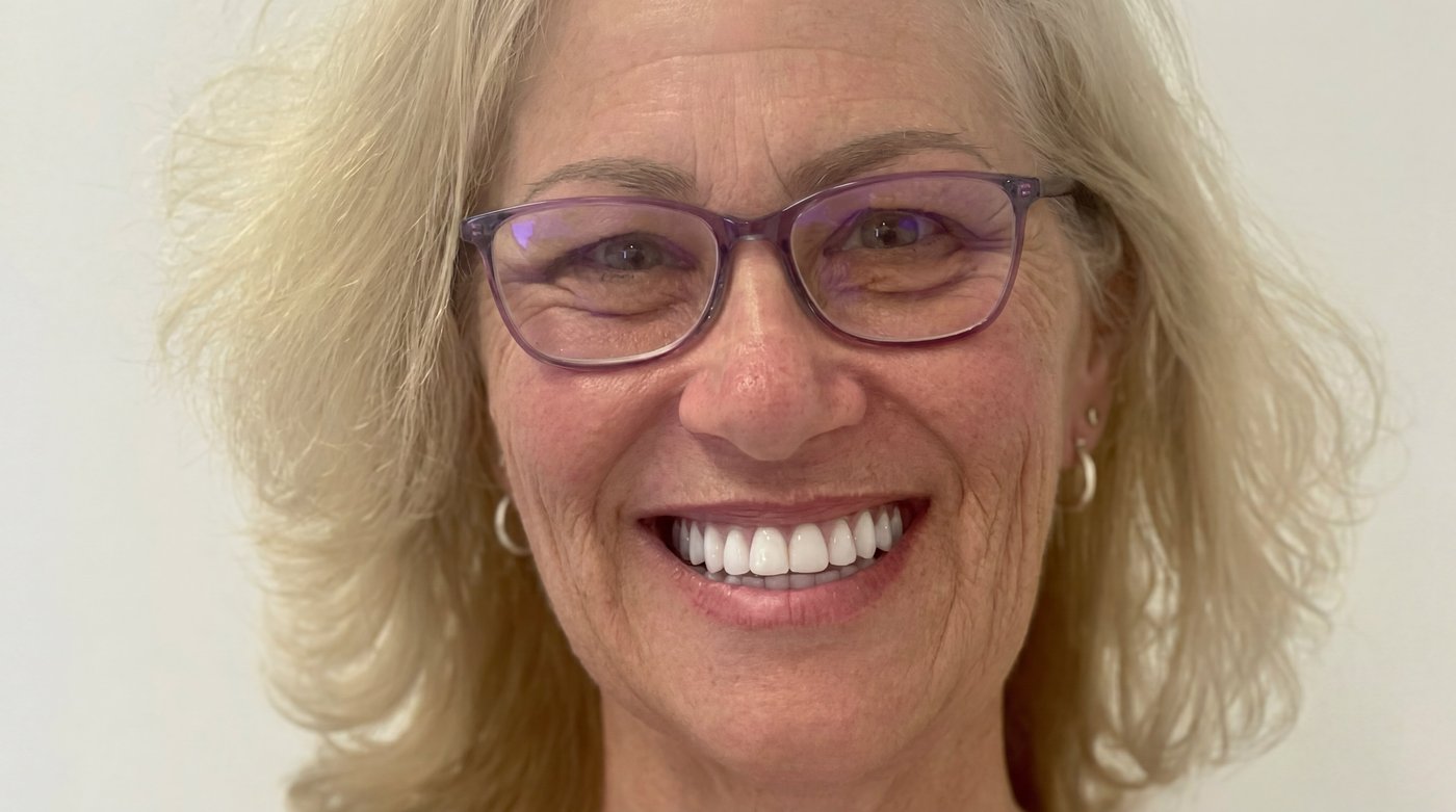 Norlane Dental All-on-X dental implants patient smiling — Geelong
