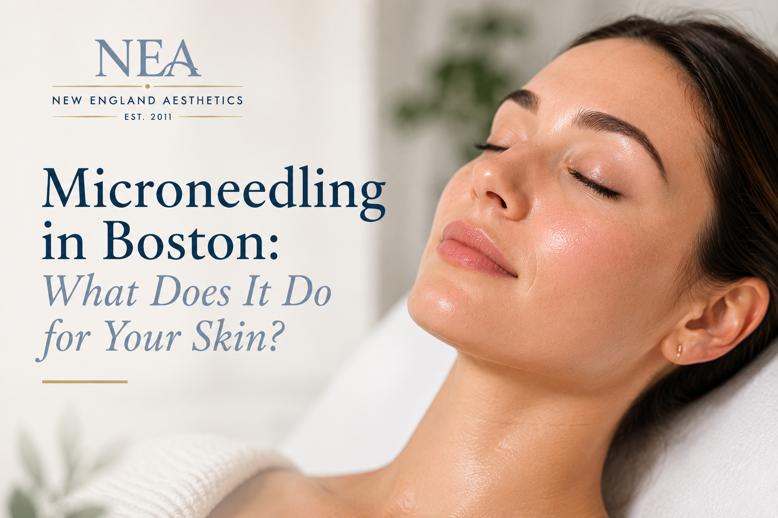 Microneedling in Boston: What Does It Do for Your Skin?